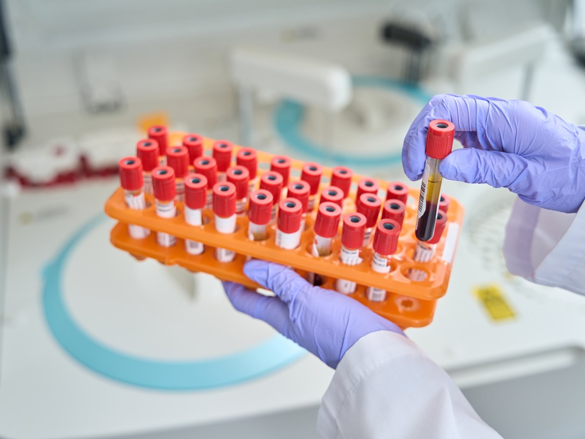 Tubos de analítica en un laboratorio para medir metales pesados en sangre