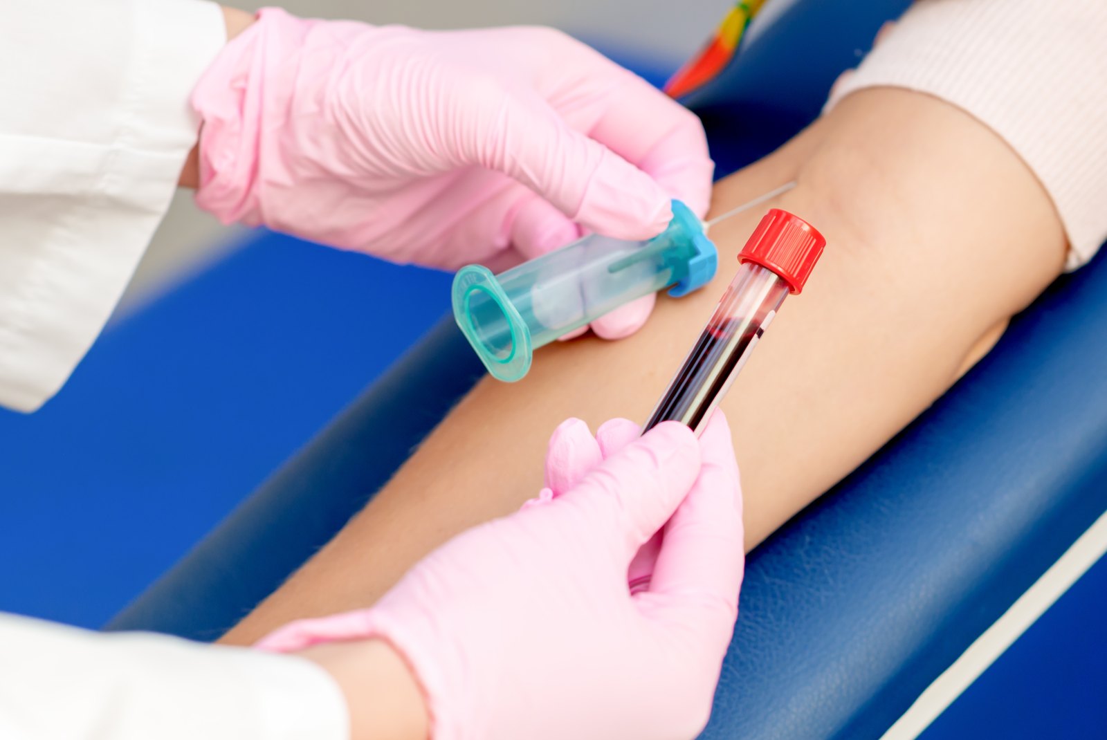 Extracción de sangre en el brazo para un análisis de vitamina B12